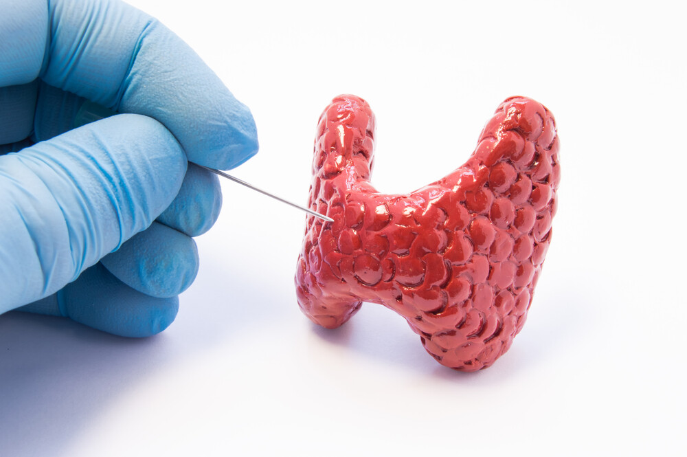 thyroid biopsy
