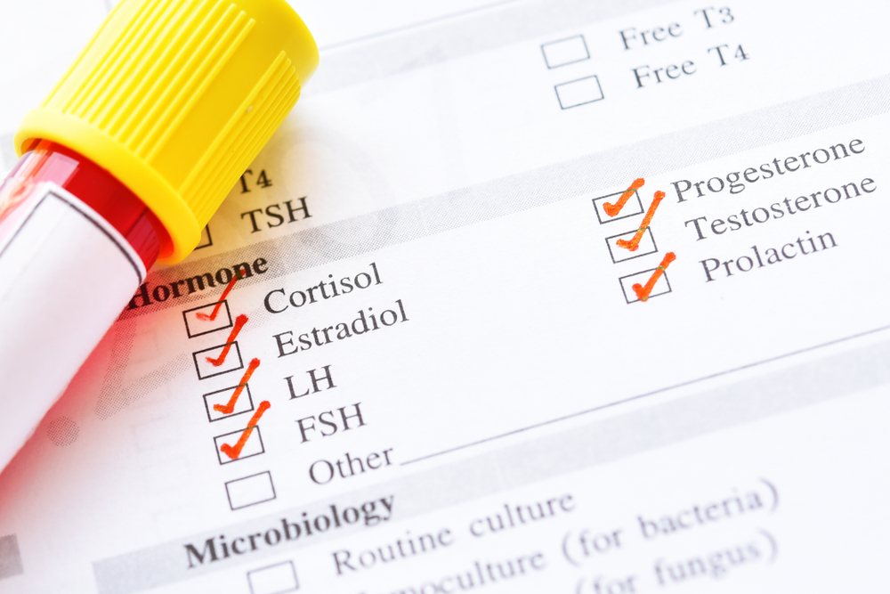 naturopathic blood test