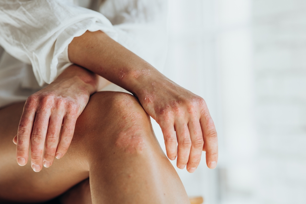 dry skin during menopause