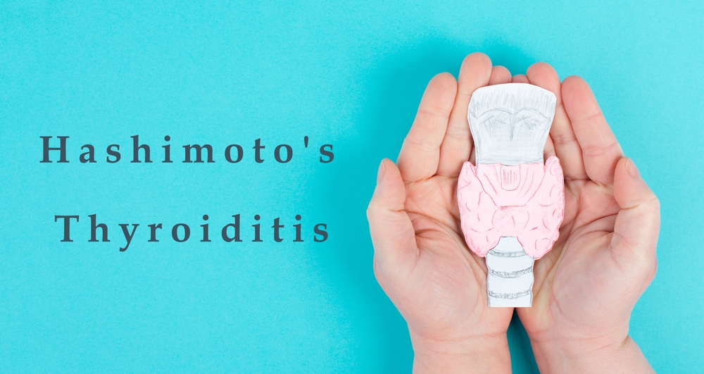 Doctor discussing autoimmune disease and unexplained weight gain
